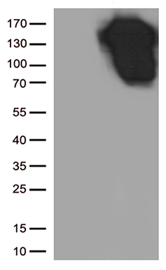 E Cadherin (CDH1) antibody