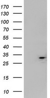 Mitocondrial Translational Initiation Factor 3 (MTIF3) antibody