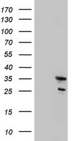 SEN1 (MORF4) antibody
