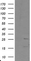 TMS1 (PYCARD) antibody
