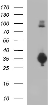 DHLAG (CD74) antibody