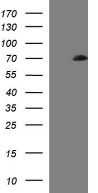 Sterol carrier protein 2 (SCP2) antibody