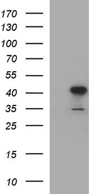 UCHL5IP (HAUS7) antibody