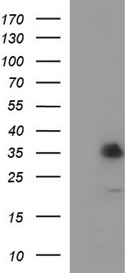 TXNDC (TMX1) antibody