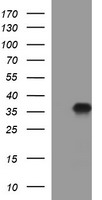 PPAP2A (PLPP1) antibody