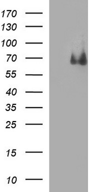 p60 CAF1 (CHAF1B) antibody