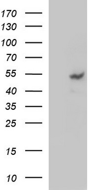 MMP13 antibody