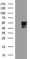 MMP13 antibody
