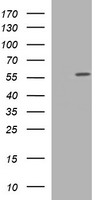 TUBA6 (TUBA1C) antibody