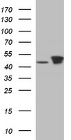 TUBB2B antibody