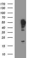 beta II Tubulin (TUBB2A) antibody