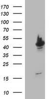 beta II Tubulin (TUBB2A) antibody