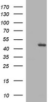 TGF beta 1 (TGFB1) antibody