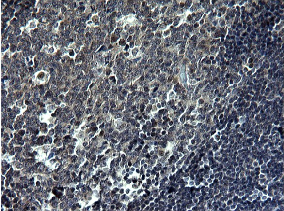 TNF alpha Antibody