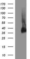 Synaptophysin (SYP) antibody