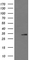 IL1 beta (IL1B) antibody