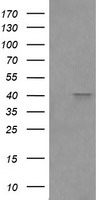 CD64 (FCGR1A) antibody