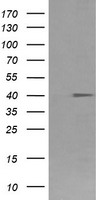 CD64 (FCGR1A) antibody