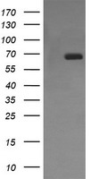 CD105 (ENG) antibody