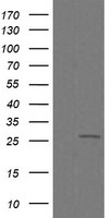 CFAP299 antibody