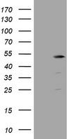 TBC1D13 antibody