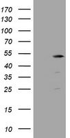 TBC1D13 Antibody