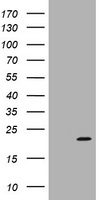 p16 ARC (ARPC5) antibody