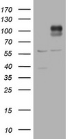 ADAMTS8 antibody