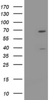 HTF9C (TRMT2A) antibody