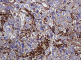 FNDC4 Antibody