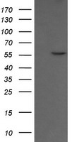 CESK1 (CCT8L2) antibody