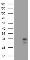 Mitochondrial ribosomal protein L11 (MRPL11) antibody