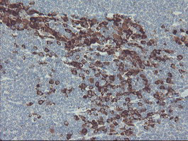 SCYL1BP1 (GORAB) antibody
