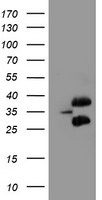 UBC6e (UBE2J1) antibody