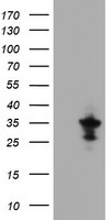 EVA1 (MPZL2) antibody