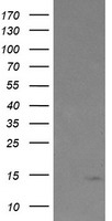 Tumor protein D52 like 3 (TPD52L3) antibody