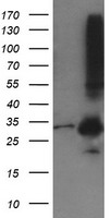 MMACHC Antibody