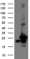 PFDN3 (VBP1) antibody