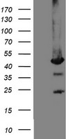 Mannose Phosphate Isomerase (MPI) antibody
