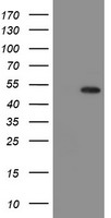 Mannose Phosphate Isomerase (MPI) antibody