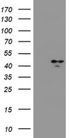 HSD17B2 antibody