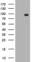 Transferrin Receptor 2 (TFR2) antibody