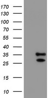 PGP9.5 (UCHL1) antibody