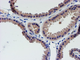 LECT2 Antibody