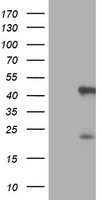 SERPINB6 antibody