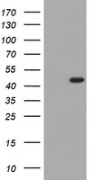 Kv beta 1 (KCNAB1) antibody