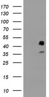 PDSS2 antibody