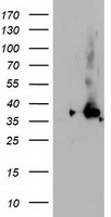NUDT18 antibody