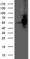 HARS2 Antibody