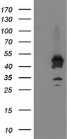 ASCC1 antibody